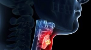 Read more about the article The best foods to support your thyroid